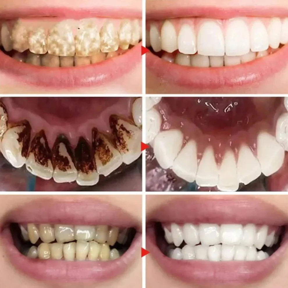 Aclarador Dental V34 Lilás